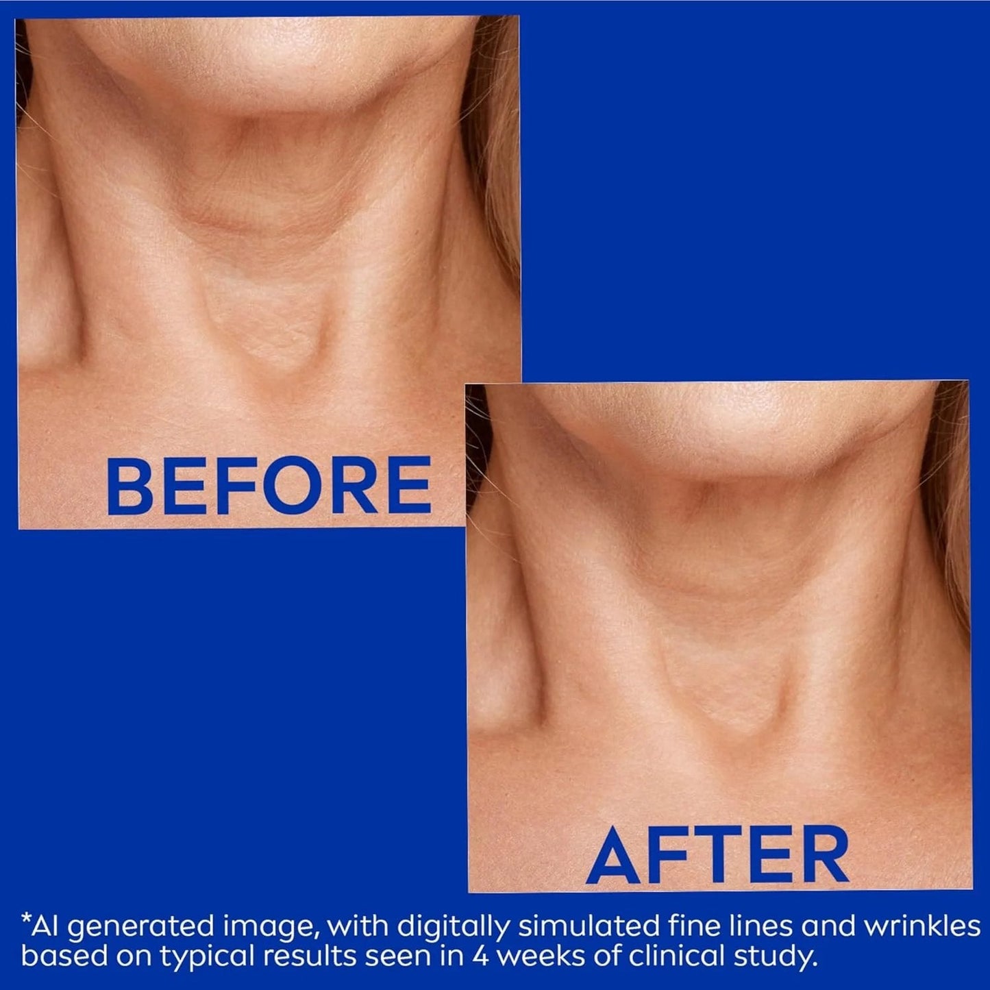 Roller Massage Neck Cream 🧴 Collagen & Hyaluronic Acid | Firms Neck, Reduces Wrinkles & Double Chin