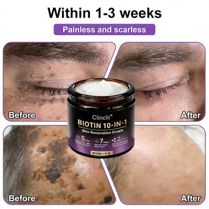 Made and Shipped from USA🍁Clinclii® Biotin 10-in-1 Skin Restoration Cream - Last Day Promotion: 75% OFF