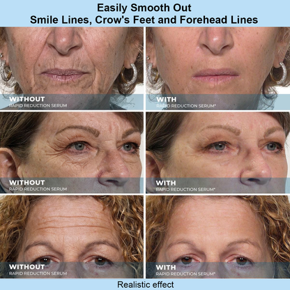 QIAWI™ Instant Face Temporary Tightener – Instant visible results in 30 seconds