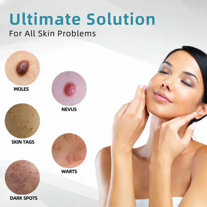 LOVILDS®  All-in-One CO₂ Laser Eraser Pen | Removes Moles, Warts, Skin Flaws & Pigmentation
