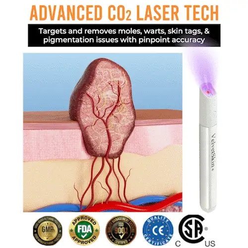 LOVILDS®  All-in-One CO₂ Laser Eraser Pen | Removes Moles, Warts, Skin Flaws & Pigmentation