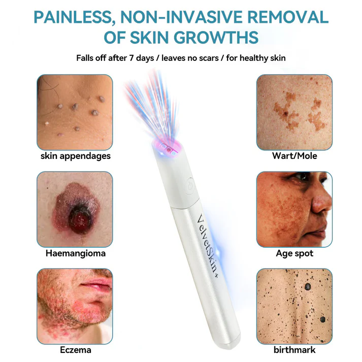 LOVILDS®  All-in-One CO₂ Laser Eraser Pen | Removes Moles, Warts, Skin Flaws & Pigmentation
