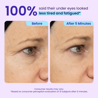 NEW🔥!  LOVILDS® Instant Lift Eye Gel — Reduce the Look of Eye Bags in Minutes