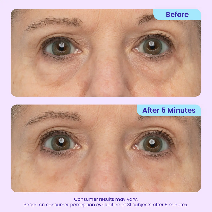 NEW🔥!  LOVILDS® Instant Lift Eye Gel — Reduce the Look of Eye Bags in Minutes