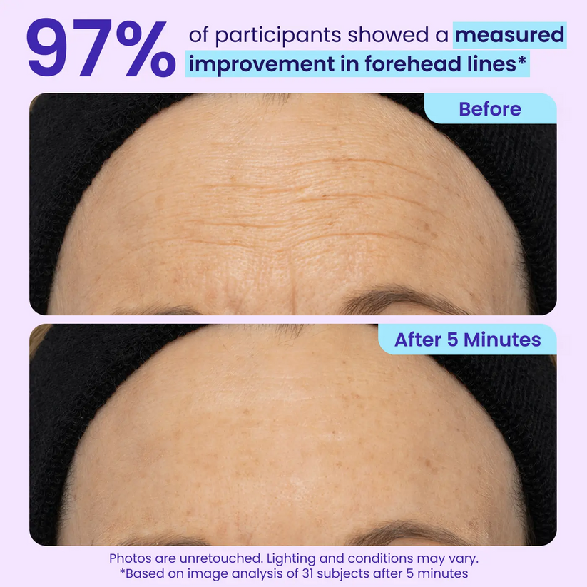 NEW🔥!  LOVILDS® Instant Lift Eye Gel — Reduce the Look of Eye Bags in Minutes