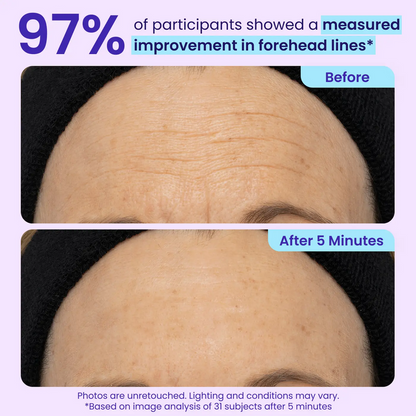NEW🔥!  LOVILDS® Instant Lift Eye Gel — Reduce the Look of Eye Bags in Minutes