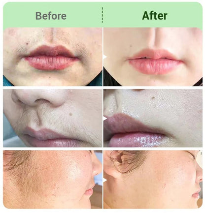 TAILEDEN™ Hair Removal Cream for All Women & Men