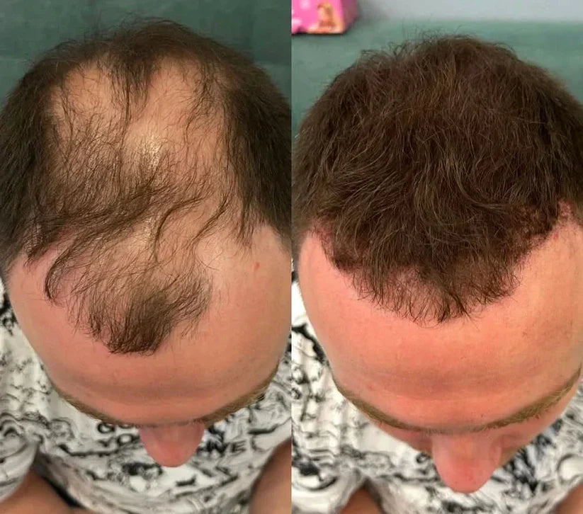 TAILEDEN® Densify – Advanced Hair Growth & Thickening Treatment for Fuller, Stronger, Healthier Hair