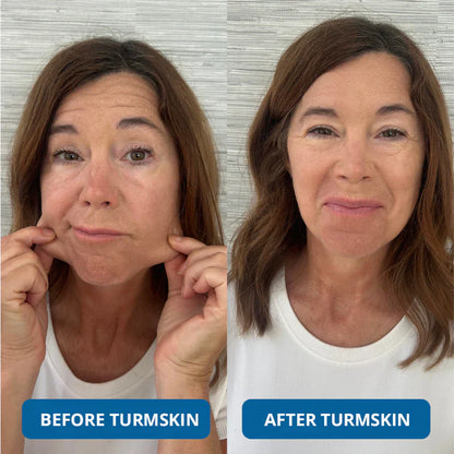 Skavix® 3% Hyaluronic Acid Ultra Hydrating Serum