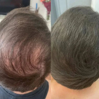 TAILEDEN® Densify – Advanced Hair Growth & Thickening Treatment for Fuller, Stronger, Healthier Hair