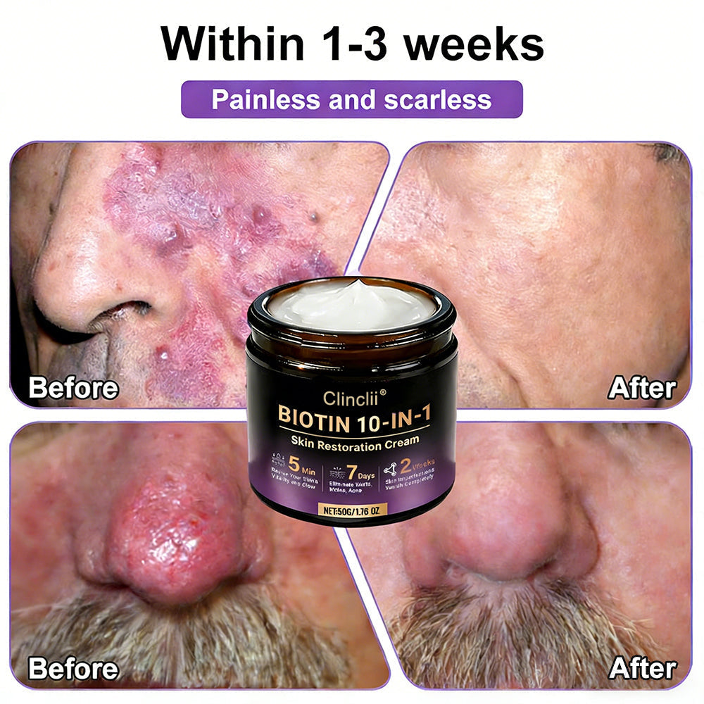 Made and Shipped from USA🍁Clinclii® Biotin 10-in-1 Skin Restoration Cream - Last Day Promotion: 75% OFF
