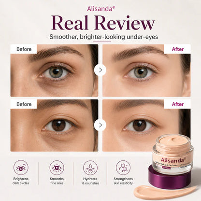Last day Buy 1 Get 1 Free !✨Alisanda Calcium Dark Spot Eye Cream