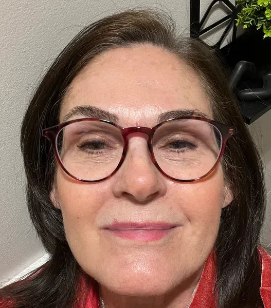Last day Buy 1 Get 1 Free !✨Alisanda Calcium Dark Spot Eye Cream