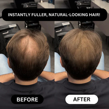 TAILEDEN® Densify – Advanced Hair Growth & Thickening Treatment for Fuller, Stronger, Healthier Hair