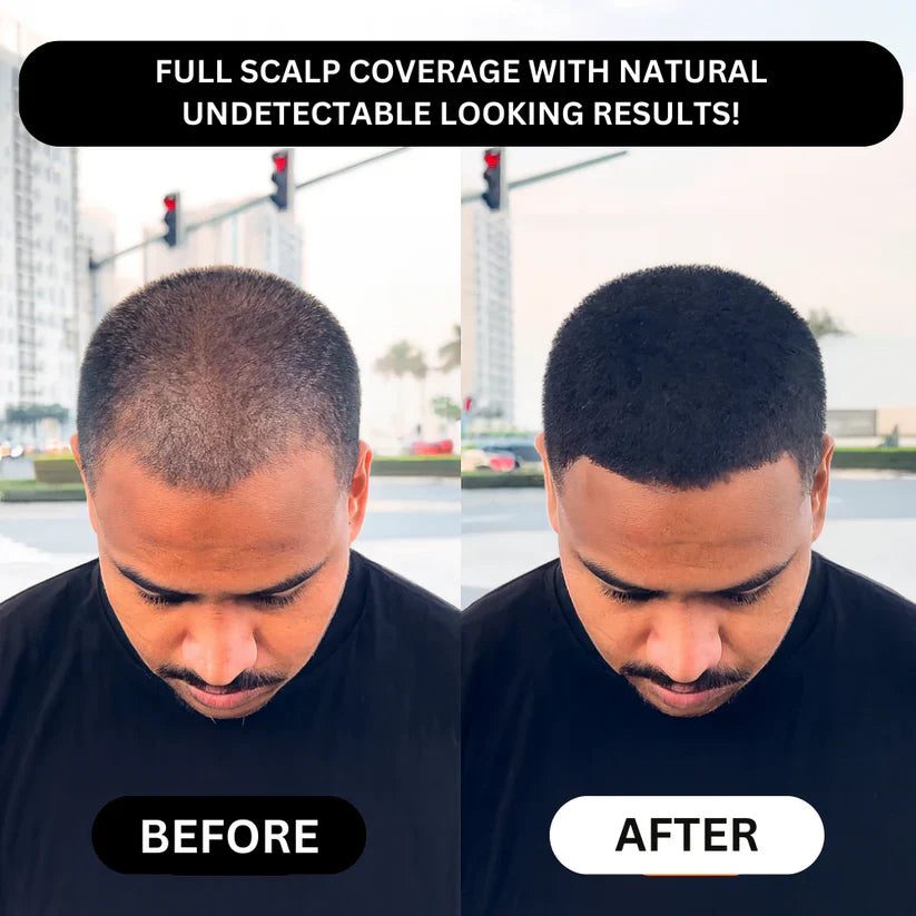 TAILEDEN® Densify – Advanced Hair Growth & Thickening Treatment for Fuller, Stronger, Healthier Hair