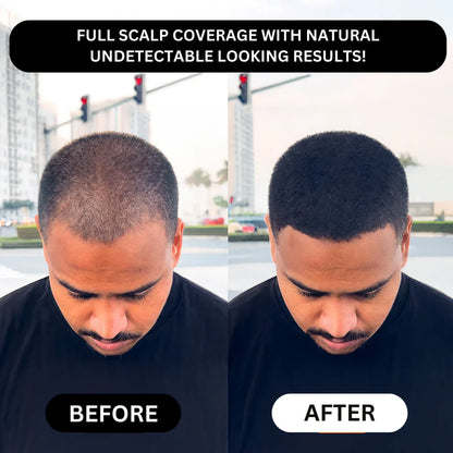 TAILEDEN® Densify – Advanced Hair Growth & Thickening Treatment for Fuller, Stronger, Healthier Hair