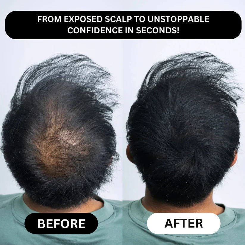 TAILEDEN® Densify – Advanced Hair Growth & Thickening Treatment for Fuller, Stronger, Healthier Hair