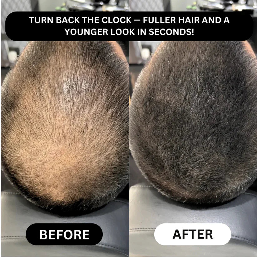 TAILEDEN® Densify – Advanced Hair Growth & Thickening Treatment for Fuller, Stronger, Healthier Hair