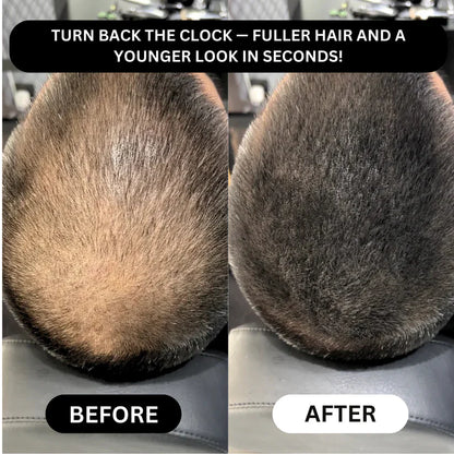 TAILEDEN® Densify – Advanced Hair Growth & Thickening Treatment for Fuller, Stronger, Healthier Hair