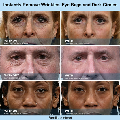 QIAWI™ Instant Face Temporary Tightener – Instant visible results in 30 seconds